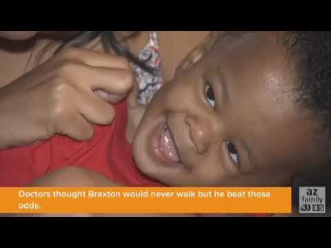 VIDEO: Video of boy with disorder walking goes viral