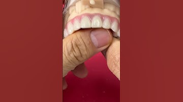 Unique Titanium Partial @EnvisiontecMain #envisiontec