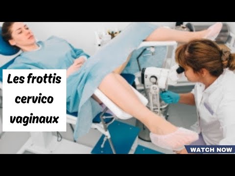 Vidéo: Le test de frottis peut-il provoquer des règles ?