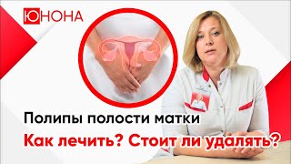 Полипы полости матки. Как лечить? Стоит ли удалять полипы?