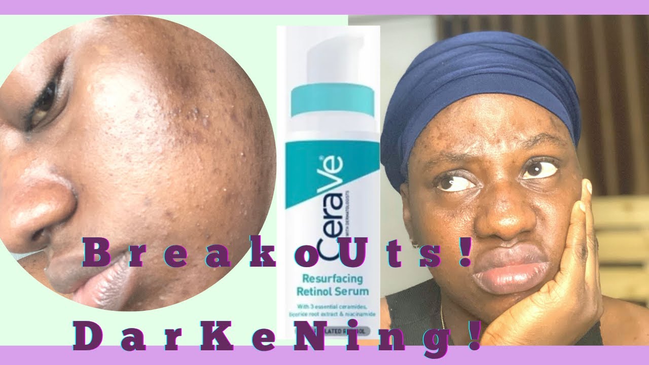 CERAVE RESURFACING RETINOL SERUM REVIEW It made me Breakout and