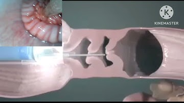 Artificial insemination process 3D video in cattle || Al technique in cattle #chouhandoctorakanwali