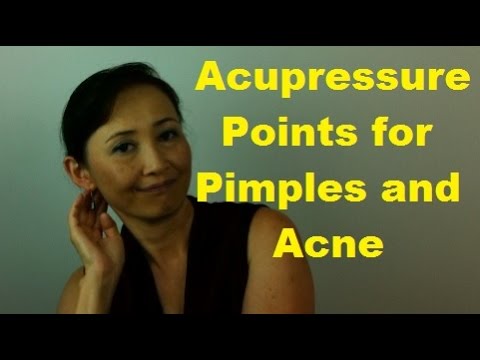 Acupressure Points for Pimples and Acne - Massage Monday #246