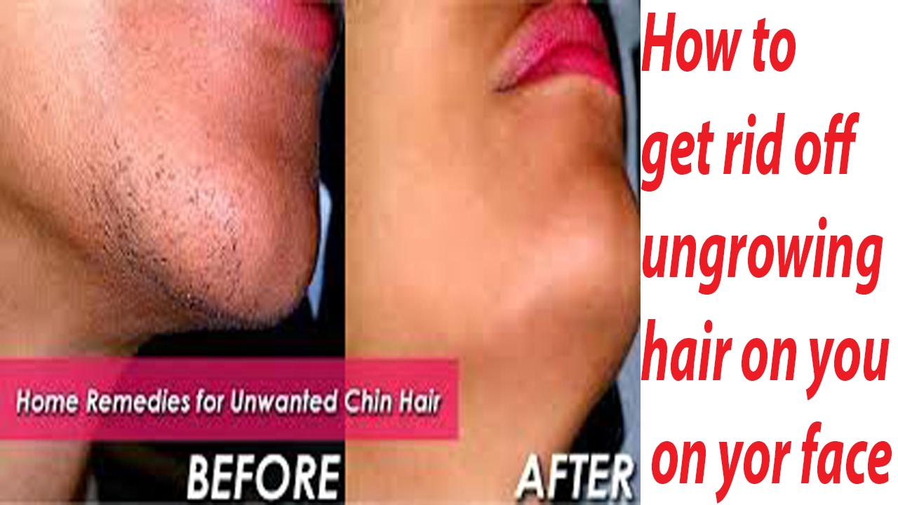 How To Get Rid Of Ingrown Hairs Home Remedies For Ingrown Hair