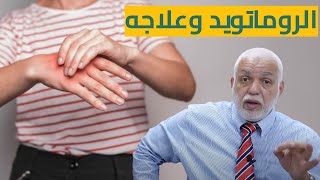 علاج الروماتويد