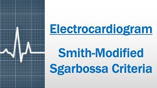 Modified Sgarbossa criteria - STEMI equivalent [Electrocardiogram]