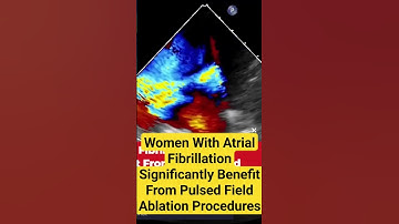 Women With Atrial Fibrillation Significantly Benefit From Pulsed Field Ablation Procedures