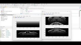 Image Reconstruction for Magnetic Resonance Imaging (MRI) using MATLAB  | MATLABSolutions