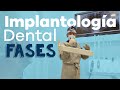 Colocación implantes dentales│Fases. Clínicas Cleardent