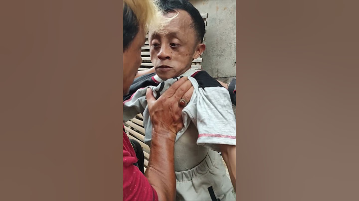 Teguh Cilik Viral Melotot
