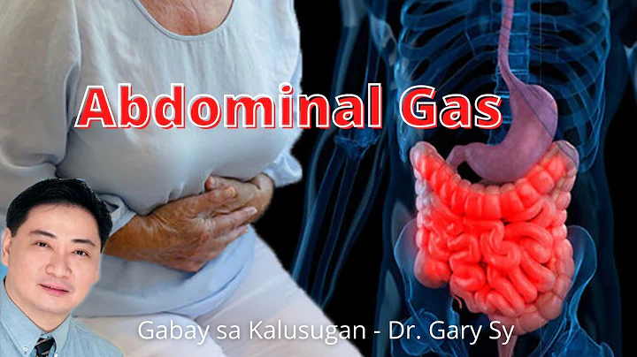 Abdominal Gas - Dr. Gary Sy