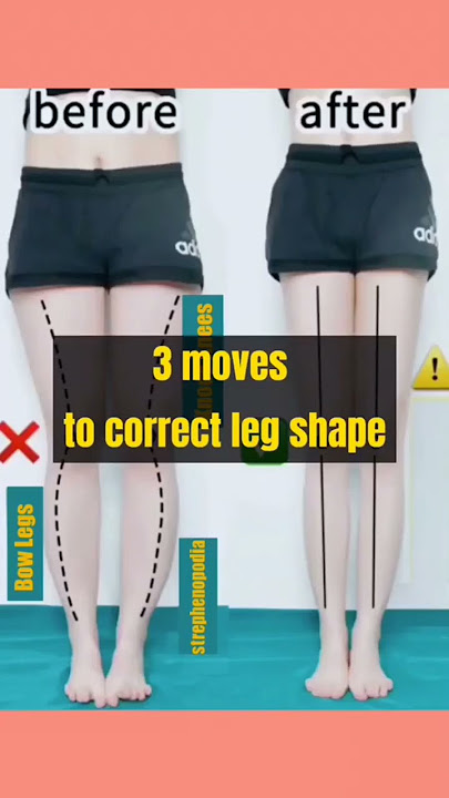 3 moves to correct leg shape #physiofitness