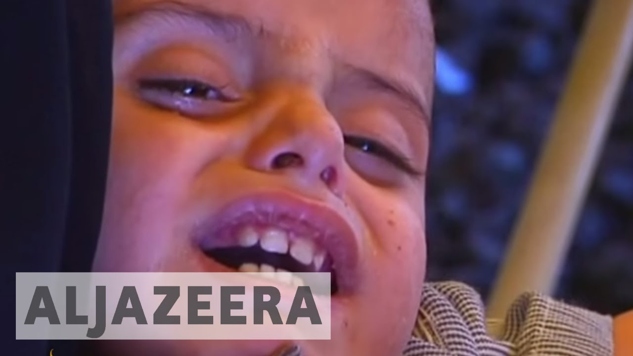 يثير الحصار السعودي لوصول المساعدات الإنسانية إلى اليمن قلق الأمم المتحدة