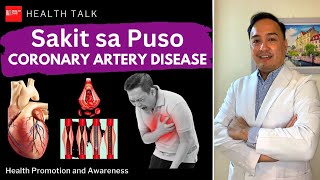 Sakit sa Puso (Coronary Artery Disease): Paano makakaiwas at ano ang lunas?