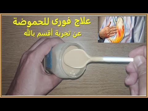 علاج الحموضه فى ثوانى عن تجربة بأسهل وصفة