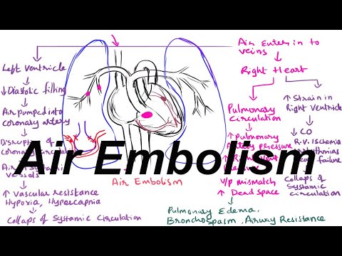 Air Embolism/ pathophysiology of Air embolism