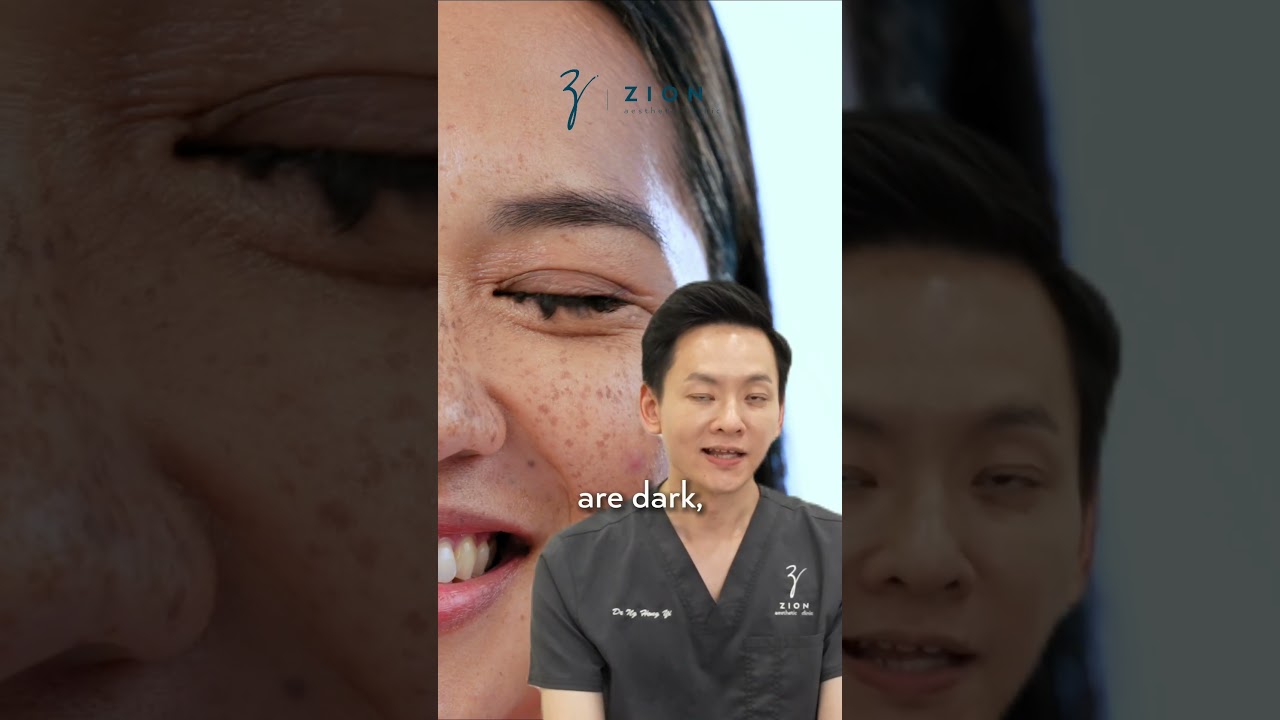 Zion Aesthetic Clinic: Common Problems #2 - Types of Pigmentation