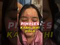 Day 32/90, 👌👌😍😍 Pimples Treatment / Pimples Removal at Home Remedy Without Money | Hindi #shorts