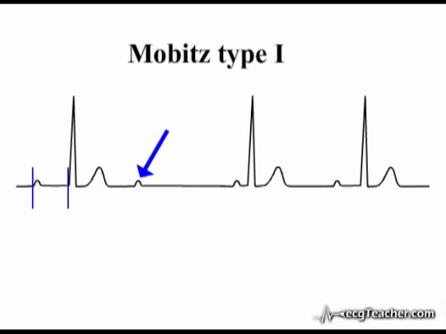 ECG Interpretation - Generation 