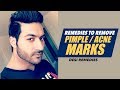 Remedies to Remove PIMPLE / ACNE MARKS by Guru Mann