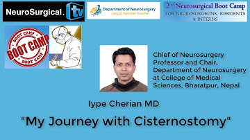 Iype Cherian MD: My Journey with Cisternostomy