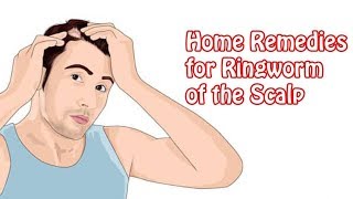 How to get rid of ringworm in 24 hours - How to treat ringworm on scalp fast