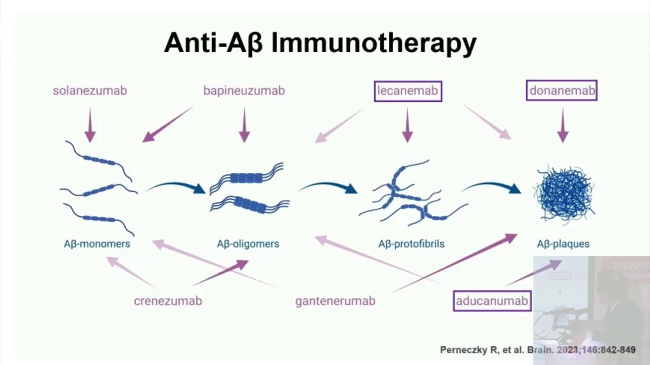 An overview on emerging disease-modifying therapies in Alzheimer’s Disease by Dr. Seán O’Dowd