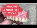 Making dentures with ivocap- all the steps #waxbae #ivocap