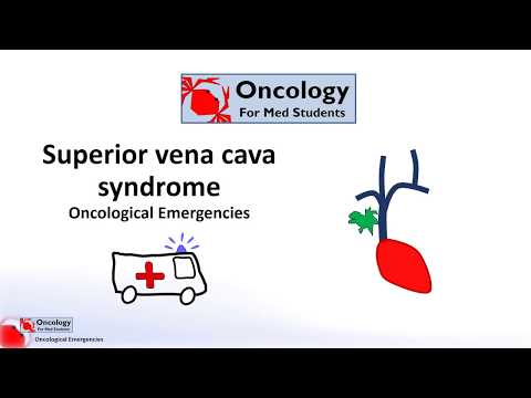 Superior vena cava syndrome