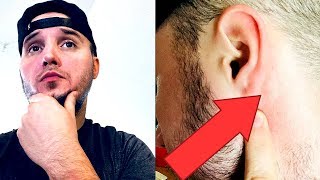LUMP BEHIND EAR UPDATE - FINAL VERDICT...
