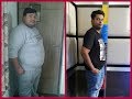 How I lost 77 kg| Best Weight loss story after Bariatric surgery| Best Bariatric surgeon in India|