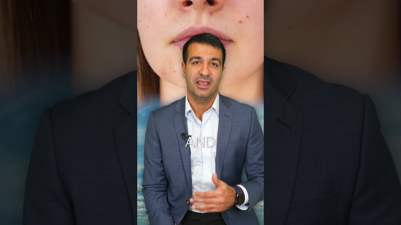 ACNE - Oral Medications