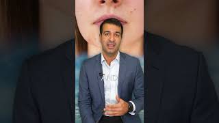 ACNE - Oral Medications