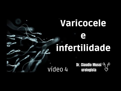 Varicocele e infertilidade