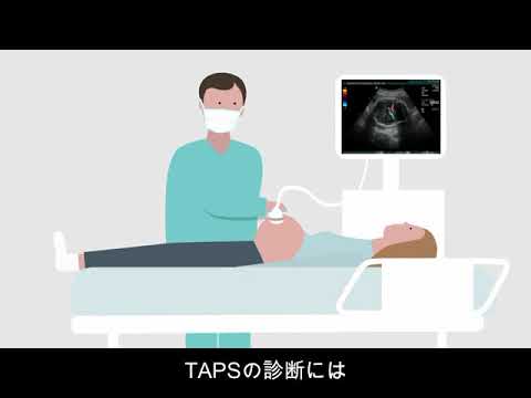 TTTS類縁疾患解説アニメーション動画