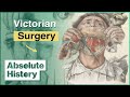 The Grisly World Of Victorian Medicine | How The Victorians Built Britain | Absolute History