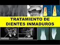 "TRATAMIENTO DE DIENTES INMADUROS" por el Dr. Eduardo Bortoluzzi