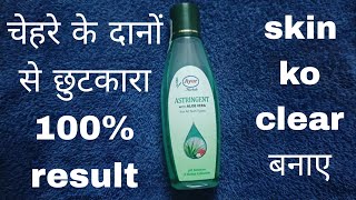 Ayur Astringent 1 हफत म Result पए Honest Review Gitika Singh