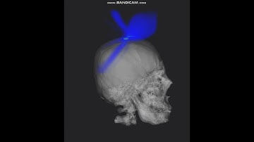 Real-time acoustic simulation depending on transducer position