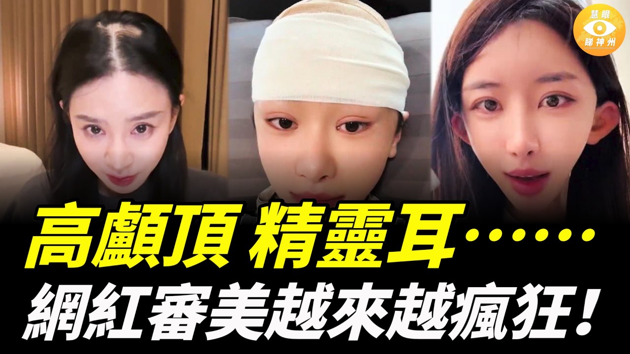 高顱頂、精靈耳……經濟蕭條下，中國網紅的審美已走火入魔，內卷越來越瘋狂……