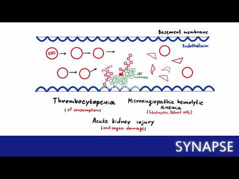 USMLE Step 1 - Тромботическая тромбоцитопеническая пурпура