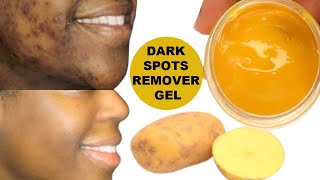 YOUR DARK SPOTS WILL BE GONE OVERNIGHT, APPLY AT NIGHT TO DARK SPOTS, WAKE UP WITH CLEAR SKIN. screenshot 2