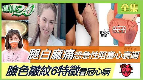 王夢麟腳變紫色 冠狀動脈堵80%！腿出現白麻痛 恐是急性阻塞 心衰竭！從臉色皺紋6特徵看冠心病！心肌梗塞年輕化 缺乏B群拉警報！吃對飲食法 血管不阻塞！ 健康2.0 20221016 (完整版) - 天天要聞