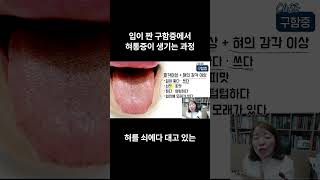 입이 짠 구함증에서 혀통증이 생기는 과정 #구함증