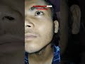 man matters minoxidil using day 5 #viralshort #keepsupporting #beardgrowth #minoxidil