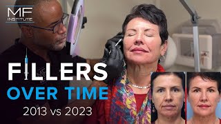 A Patient For Life: How Filler Results Progress Over Time | Mabrie Facial Institute in San Francisco