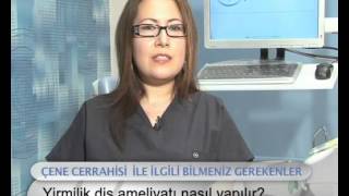 Yirmilik (gömülü) diş ameliyatı nasıl yapılır?- Fulya Özbey Erkılınç