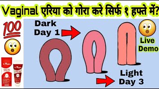 Intimate area Whitening Cream| Vaginal Whitening Cream| 100% solution to whiten private parts screenshot 4