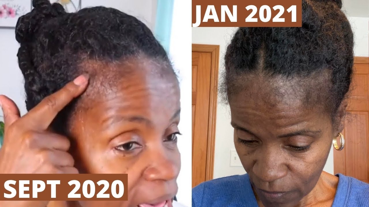 How To Use Aloe Vera To Grow Thinfine Natural Hair  ADEDE