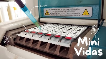 How to use Mini Vidas Hormone Analyzer | The only video you need to watch 🌸🔬